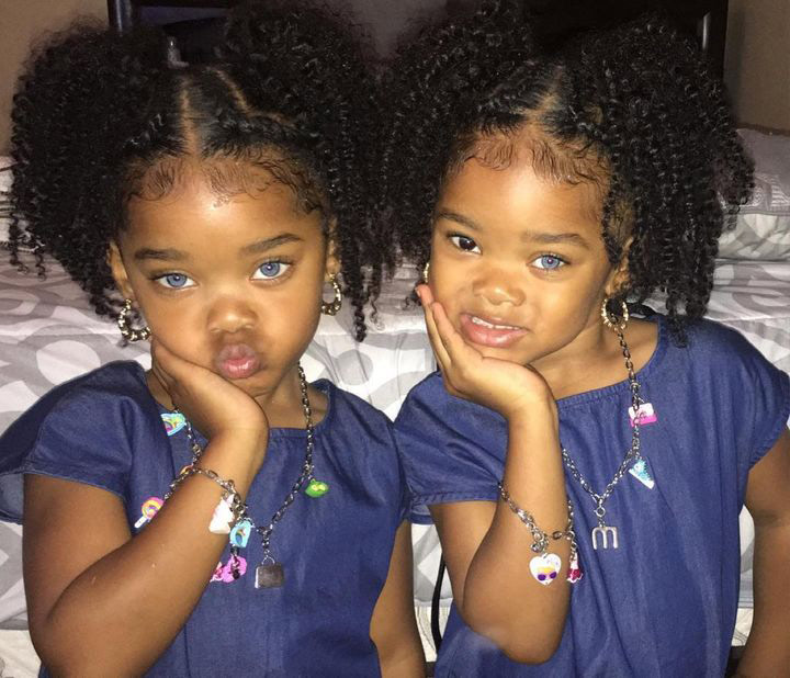 Admire the pure beauty of the colored twins with their eyes